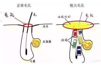 北京伊美爾愛康醫(yī)院: 點陣激光多久恢復(fù)