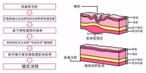 北京伊美爾健翔醫(yī)院:玻尿酸除皺的價(jià)格