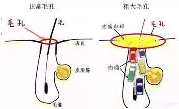 北京伊美爾愛康醫(yī)院:春季皮膚問題有哪些?