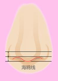 福州格萊美醫(yī)院隆鼻:鐘德成院長解析3+3立挺半肋鼻綜合