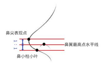 福州格萊美醫(yī)院隆鼻:鐘德成院長解析3+3立挺半肋鼻綜合