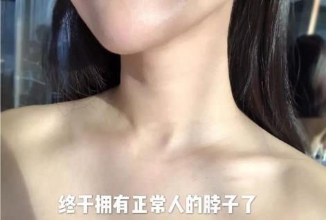 廈門薇格整形醫(yī)院去頸紋效果如何 告訴你年輕的秘密