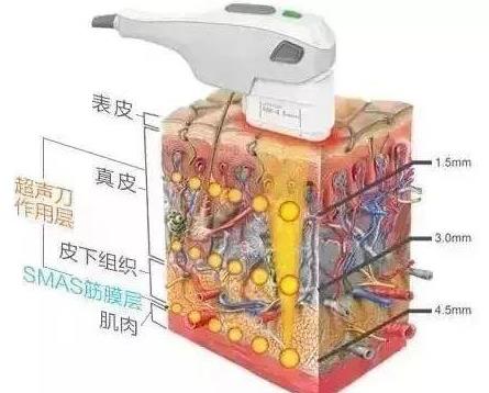 北京伊美爾愛(ài)康醫(yī)院:新熱瑪吉有什么功效