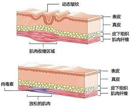 南京韓辰整形醫(yī)院費用 微整形成就靚麗女人