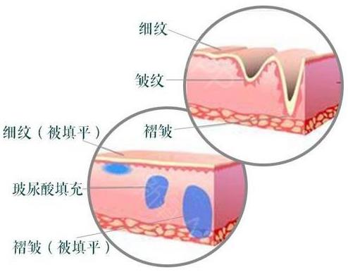 南京韓辰整形醫(yī)院費用 微整形成就靚麗女人