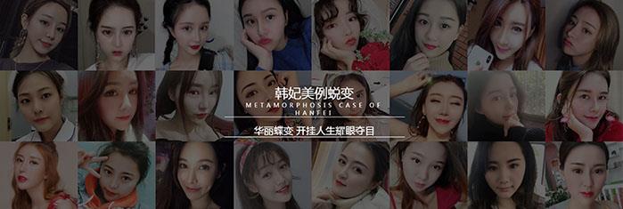 廣州韓妃整形醫(yī)院好不好?