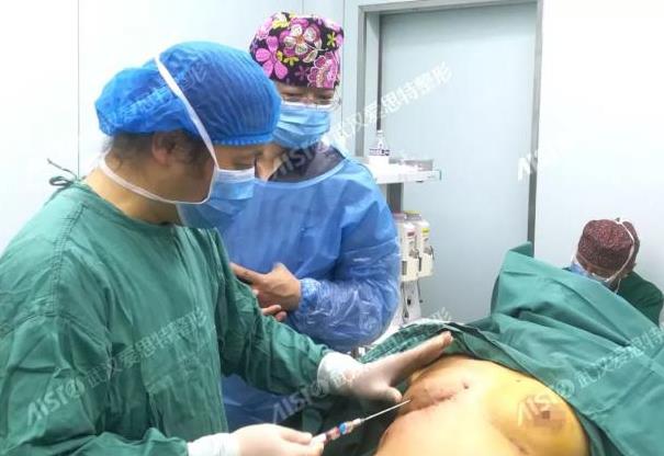愛思特張敏邁阿密乳房再造口碑如何,有案例嗎?