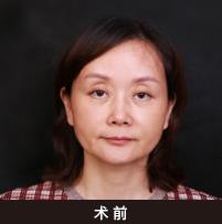 深圳美萊眼整形“雙杰”亮相2019中國眼整形高峰論壇