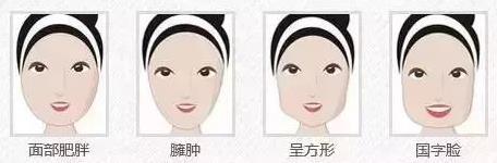 鄭州愛美麗醫(yī)院,有一種肉毒素,打了“它”,男友比原來更加愛你了!