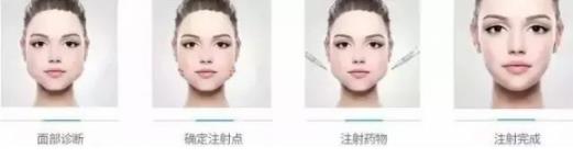 鄭州愛美麗醫(yī)院,有一種肉毒素,打了“它”,男友比原來更加愛你了!