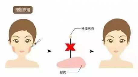 鄭州愛美麗醫(yī)院,有一種肉毒素,打了“它”,男友比原來更加愛你了!
