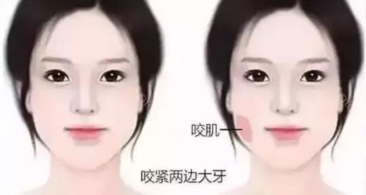 鄭州愛美麗醫(yī)院,有一種肉毒素,打了“它”,男友比原來更加愛你了!