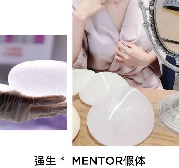 南京MEYA袁呂榮院長(zhǎng)隆胸效果怎么樣 大牌名醫(yī)親診親治
