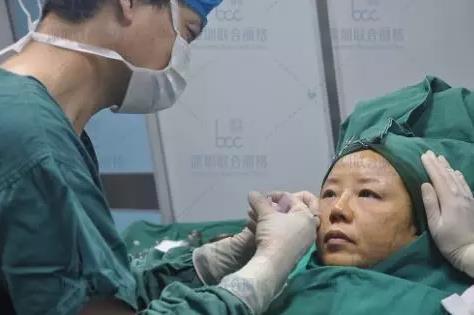 深圳聯(lián)合麗格:為什么明星一定要做熱瑪吉+線雕