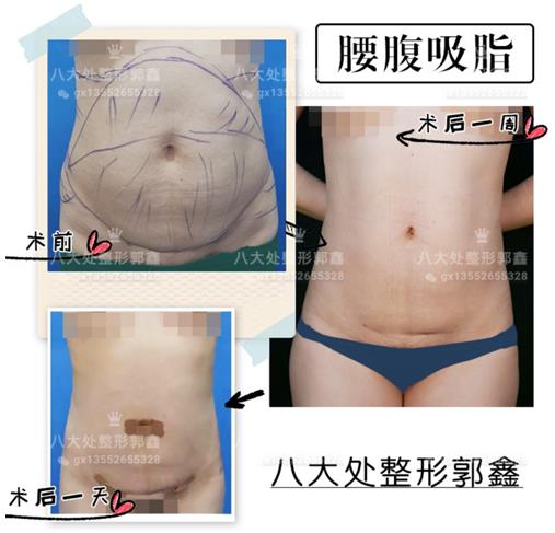 八大處整形郭鑫教授:實現(xiàn)普通女孩到女神的蛻變