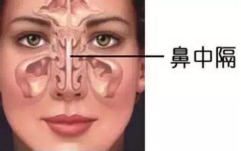 煤醫(yī)整形王馳主任:并不是什么人都適合鼻綜合手術(shù)