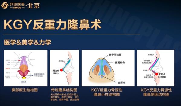 蘇亞金光逸院長(zhǎng)評(píng)價(jià)好嗎 幫你美出高度美出自信
