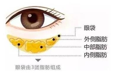 不動(dòng)刀就能祛眼袋,田永成整形:無(wú)痛隱痕一步到位