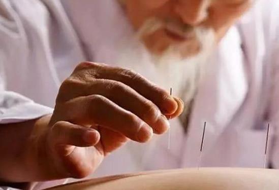 針灸減肥每天都要扎嗎?針灸減肥和埋線減肥的區(qū)別