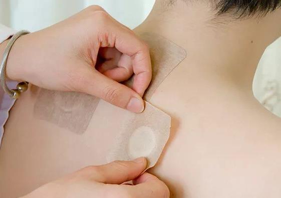 三伏貼必須晴天才能貼嗎?三伏貼什么天氣貼比較好?