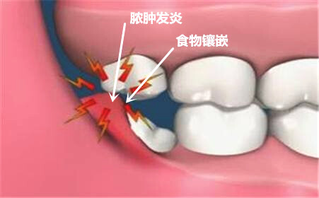 Լʳ׌XĄ(chung)ɸȾ