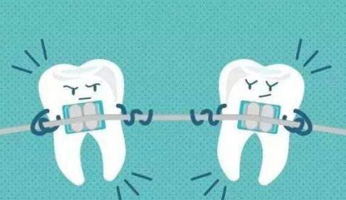 長沙牙齒矯正多少錢,矯正是否一定需要拔牙?