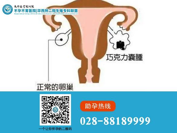 成都醫(yī)學(xué)院附屬不孕不育醫(yī)院貴不 巧克力囊腫能不治療先懷孕