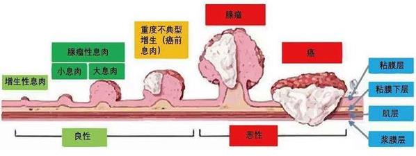 武漢漢西博仕肛腸醫(yī)院好不好 定期做肛腸檢查 可有效排查腸癌風(fēng)險