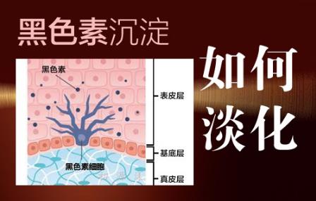 怎樣能淡化大腿內(nèi)側(cè)黑色素?這幾種方法安全又有效