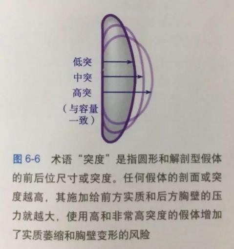 普羅普姿肖能院長科普假體隆胸如何選擇假體?