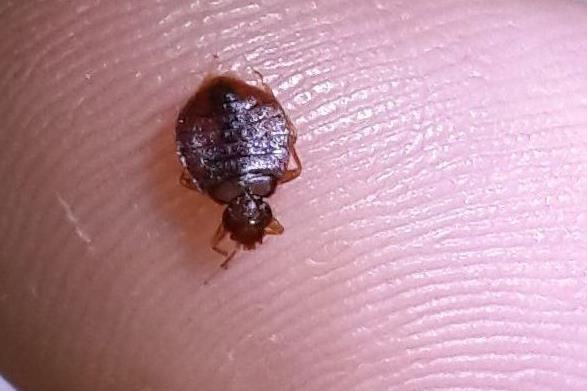 頭上有虱子怎么去除掉?虱子是怎么長出來的?虱子和跳蚤區(qū)別