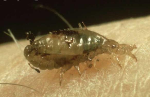 虱子為什么會咬人?身上生虱子怎么辦?如何能預(yù)防生虱子?