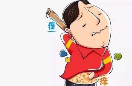 牛皮癬有哪些癥狀?患牛皮癬的原因有哪些?