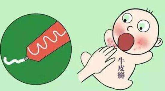 患了牛皮癬怎么護理?牛皮癬有哪些生理類型?