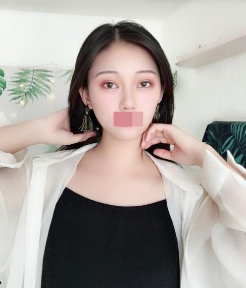 寧波玲瓏整形醫(yī)院解讀:除了忌口,做隆鼻也沒有我想的那么麻煩!