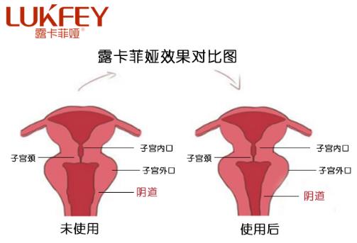 縮陰凝膠真的有用嗎?用之前4個常識需清楚!
