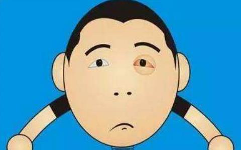 患結(jié)膜炎需要做哪些檢查?患結(jié)膜炎怎么護(hù)理?
