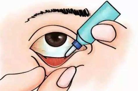 沙眼有哪些診斷?沙眼有哪些治療方法?