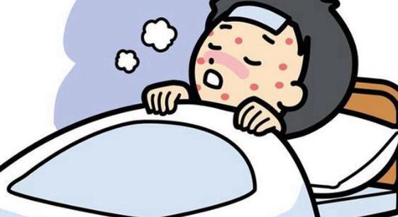 患了麻疹有哪些癥狀?哪些人容易患麻疹?