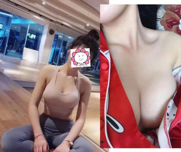 很瘦的女性假體豐胸如何選擇假體大。