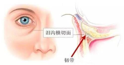 寧波薇琳整形醫(yī)院好嗎:玻尿酸填充淚溝,并不是打一針那么簡單