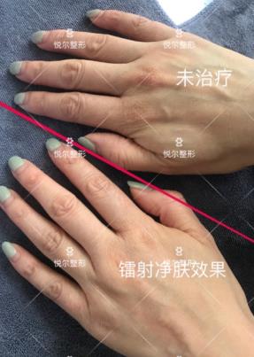 慈溪悅爾醫(yī)學(xué)美容醫(yī)院好不好?專業(yè)技術(shù) 品質(zhì)口碑