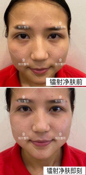 慈溪悅爾醫(yī)學(xué)美容醫(yī)院好不好?專業(yè)技術(shù) 品質(zhì)口碑