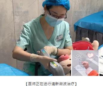 秒殺腋臭手術(shù)的止汗凈味黑科技——miraDry清新微波!