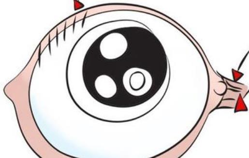 為什么會長倒睫毛?長倒睫毛有哪些危害?