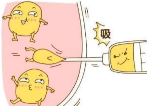 韋元強(qiáng)的SWAN脂肪修復(fù)技術(shù)好在哪里?