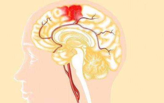 引發(fā)腦積水的原因有哪些?腦積水會(huì)有哪些后遺癥?