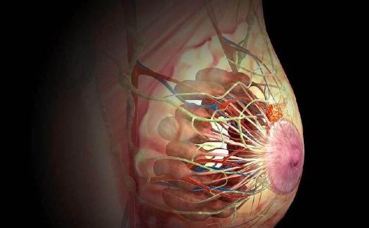 患乳腺癌需要做哪些檢查?哪些食物可以防治乳腺癌?
