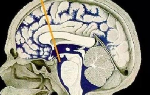 腦積水的治療方式有哪些?腦積水治療后需要補(bǔ)充哪些營(yíng)養(yǎng)?