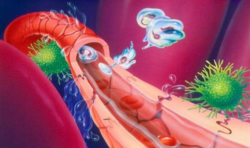 患毒血癥的病因有哪些?患毒血癥有哪些并發(fā)癥?
